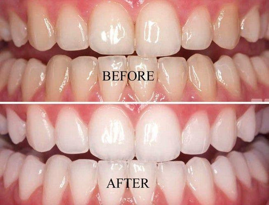 Whiten Up Teeth whitening powder for multipurpose